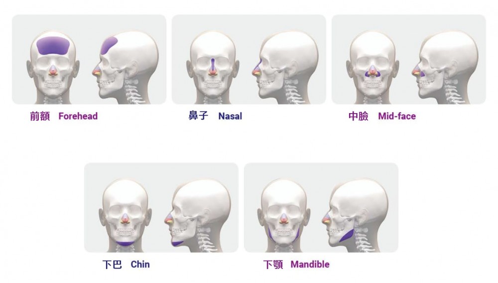 Fitme完形美 隆鼻黑科技3D列印打印鼻模,博恩妍診所